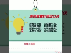 Cateteres intravenosos descartáveis ​​verdes 18G tipo borboleta CE ISO13485
